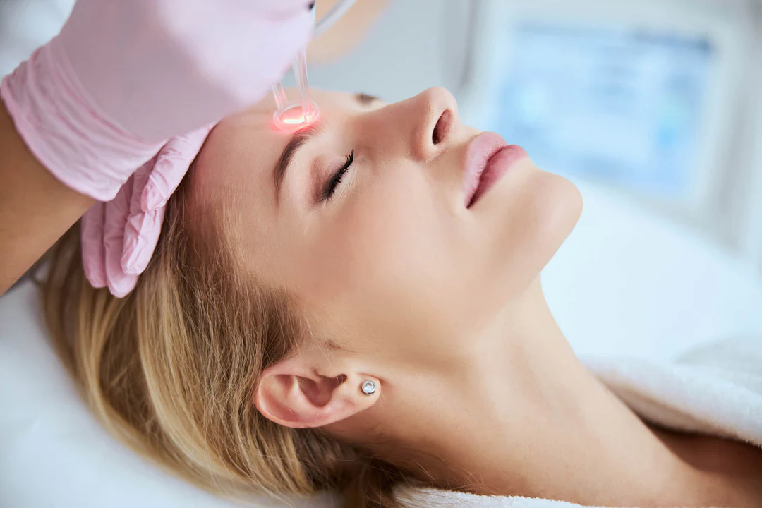 LASER CO2 TREATMENT