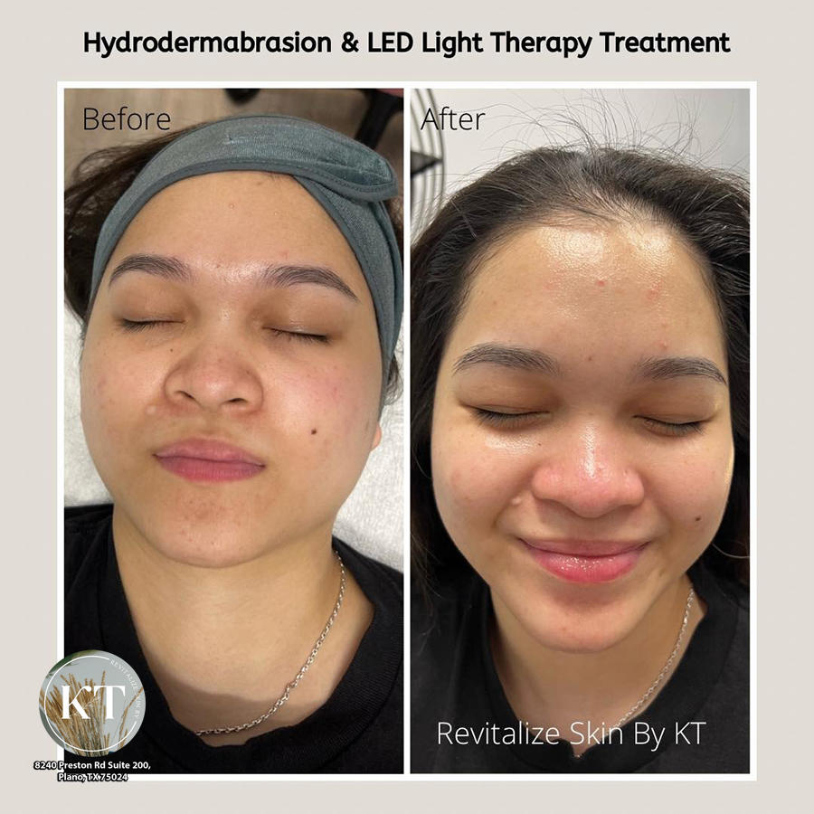 REVITALIZE SKIN BY KT - Day Spa 75024