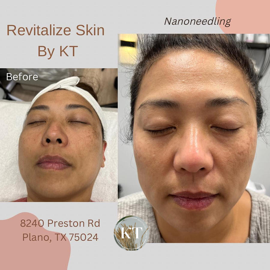 REVITALIZE SKIN BY KT - Day Spa 75024